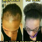 Hair Hope Growth Oil (before/after)